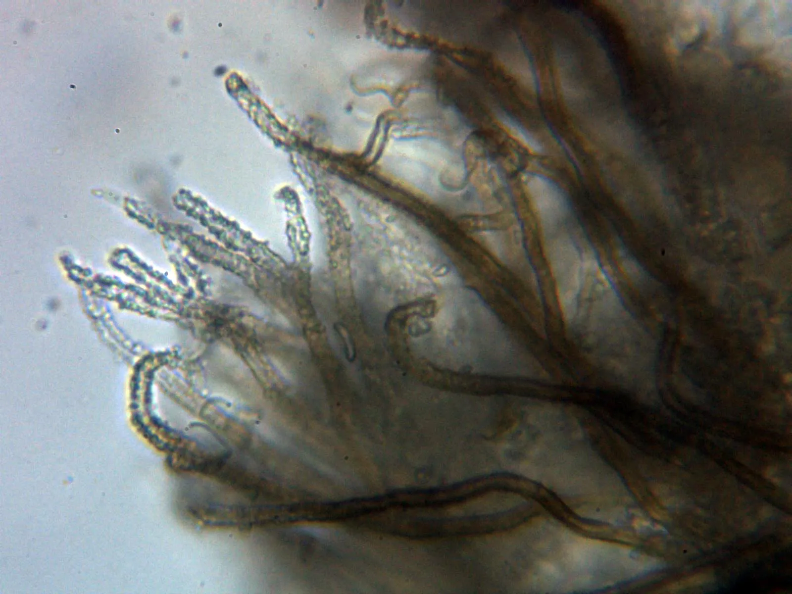Microscopía de Merismodes fasciculata - 10 - Pelos marginales agua 5